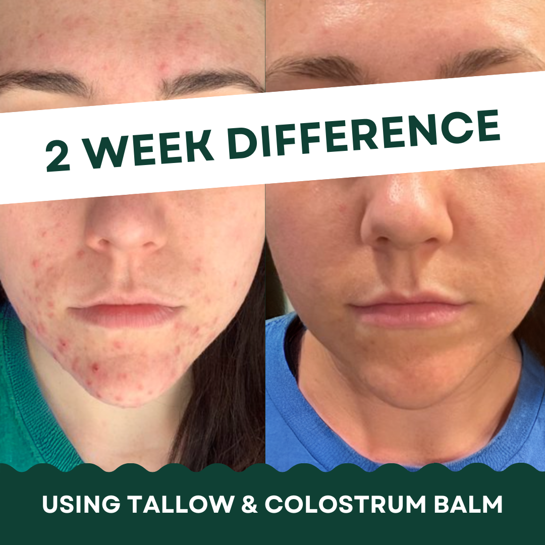 NEKTR Tallow & Colostrum Balm