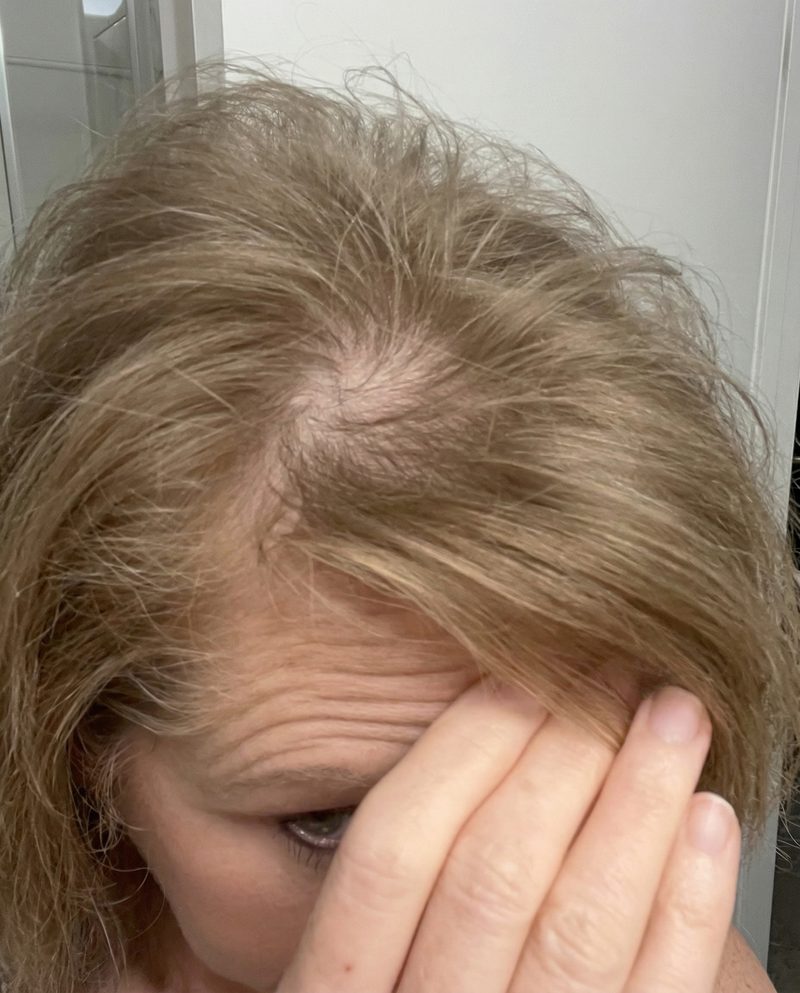 Jenn — hair before